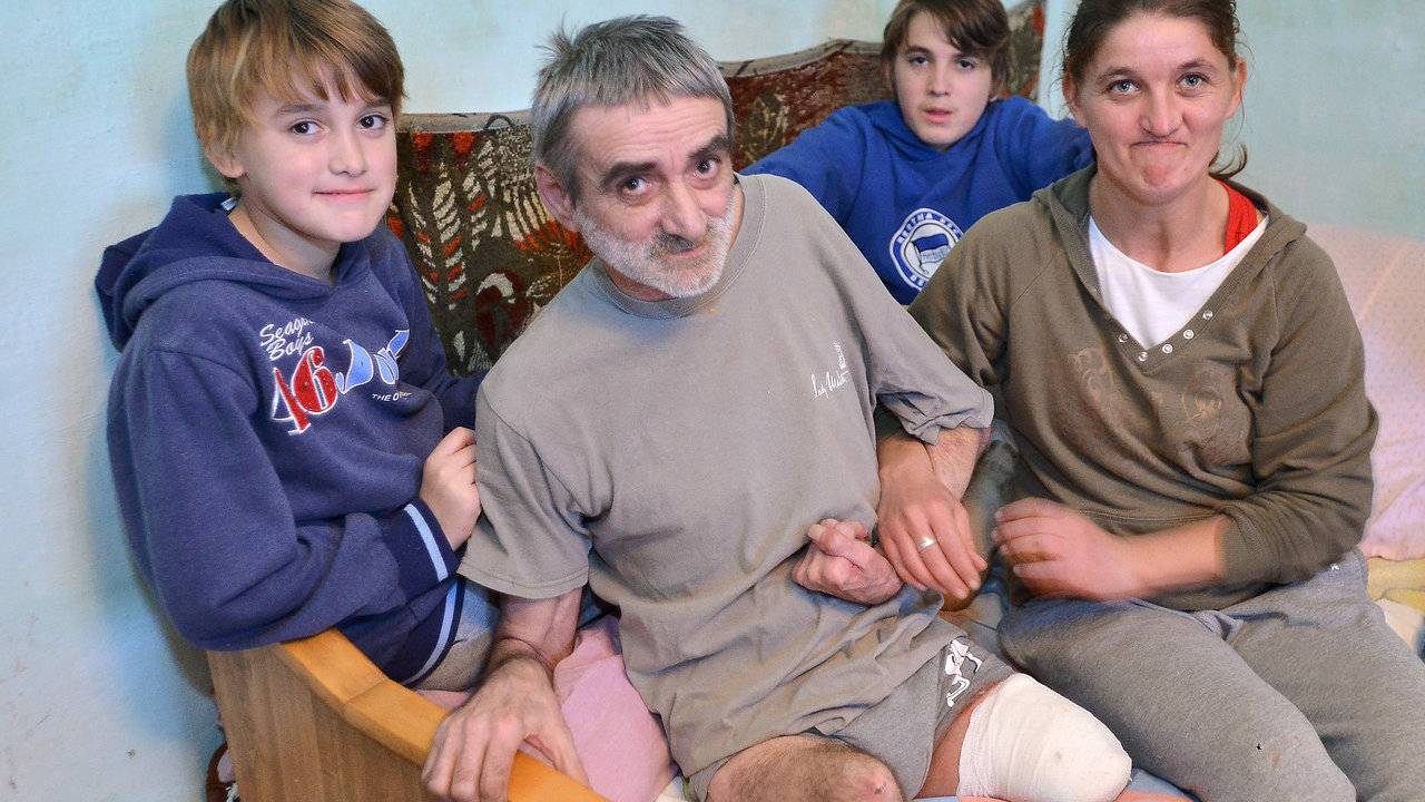 Az egész család ápolja az amputált lábú édesapát
